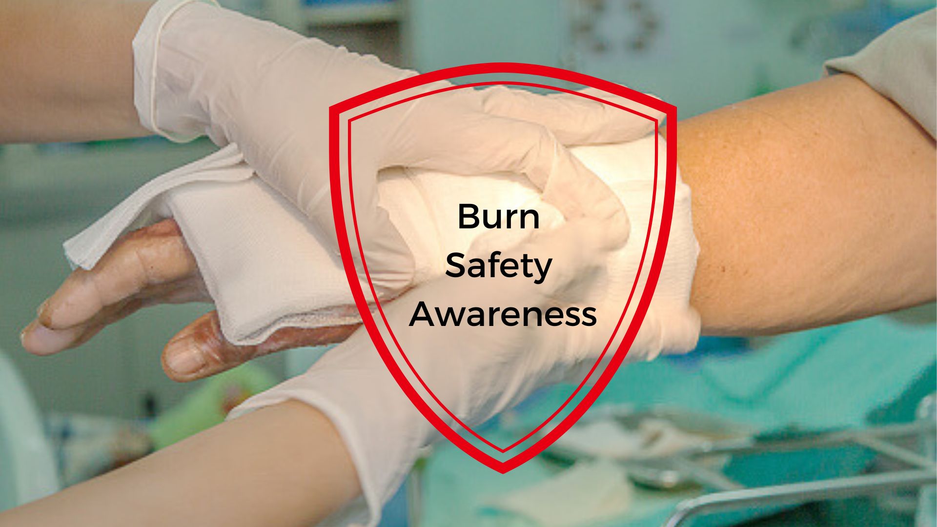 Read more about the article Burn Safety Awareness